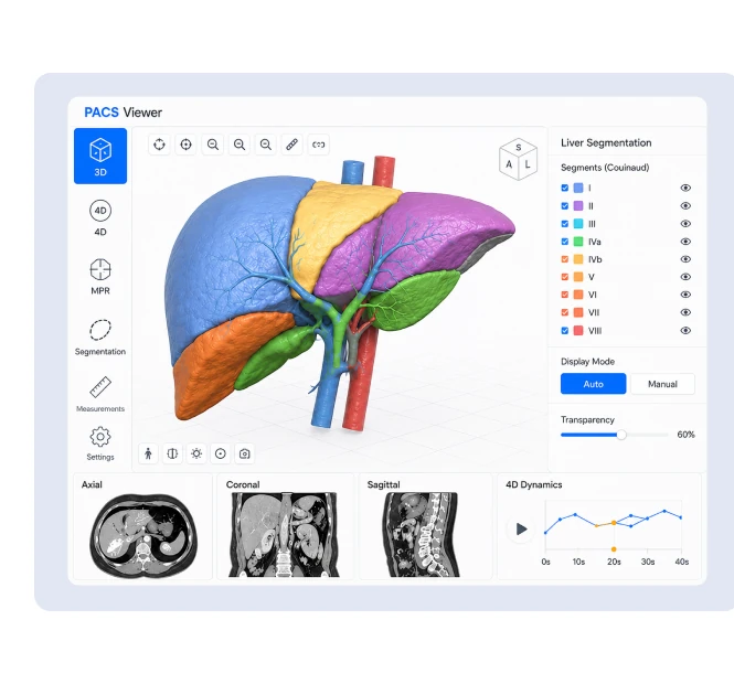 PACS Viewer with 3D liver segmentation visualization