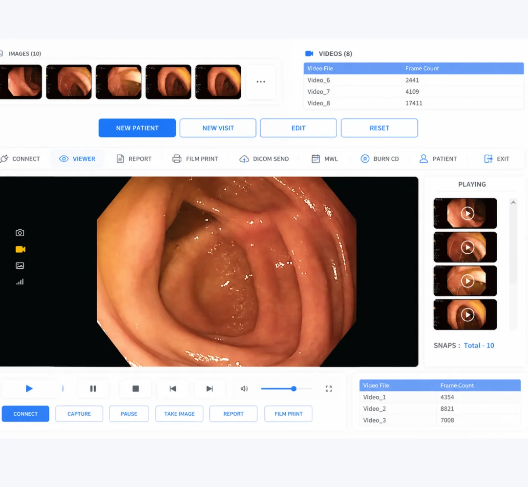 Endoscopy IMS
