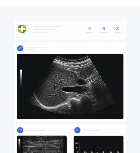 Ultrasound / Echo IMS