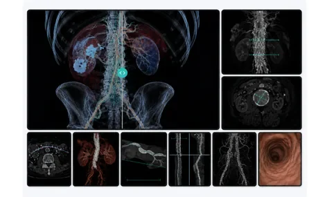 Interventional Radiology